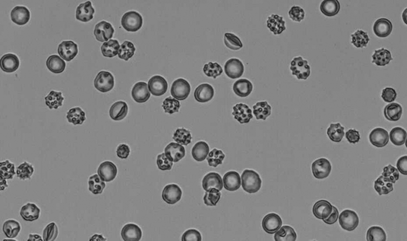 Blood Transfusions Made Safer through $1.8M Research Grant