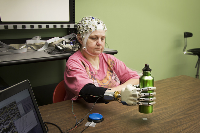 Researchers Build Brain-Machine Interface to Control Prosthetic Hand