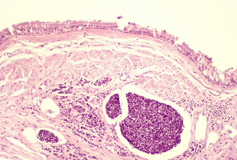 Forbes Features Immunotherapy Software Developed by UH Engineers