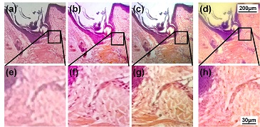 UH Researchers Create Lens to Turn Smartphone into Microscope