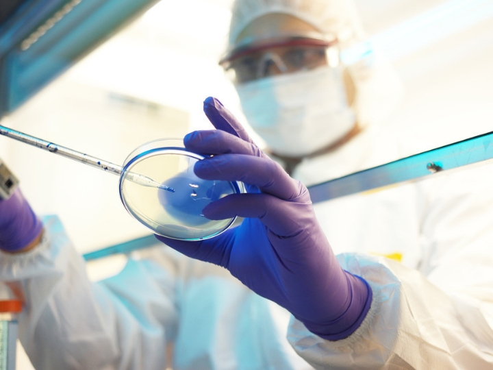 Researchers Developing Early Detection, Home Monitoring Tests for Lupus Nephritis 