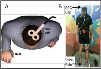 Figure 2. A: Transcranial magnetic stimulation (TMS). B:  TMS prior to performance of the balance task. EEG is assessed to understand the neurophysiological effects of TMS.
