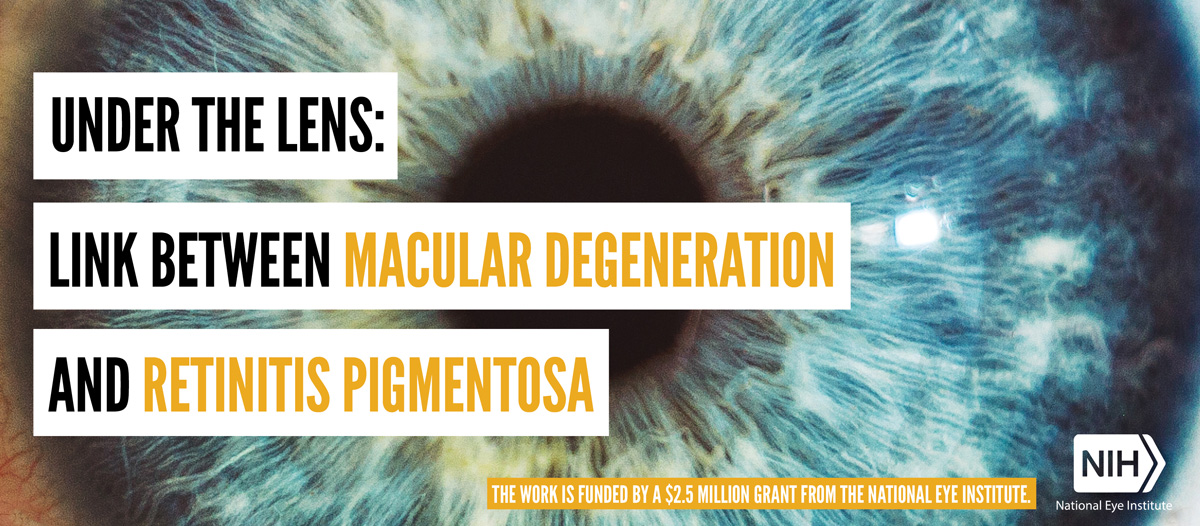 Link Between Macular Degeneration And Retinitis Pigmentosa