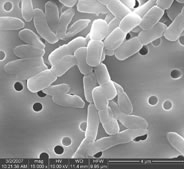 Five days later, after being exposed to the bismuth compound, Shankar Chellam, professor of environmental engineering, witnessed a 95% decrease in protein and polysaccharide secretion, which contributed to the reduction of filter clogging.