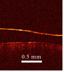 Images from a device developed by Associate Professor Kirill Larin show blood without nitrogen bubbles. A rapid decrease in air pressure can cause these bubbles to form, leading to decompression sickness. 