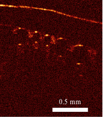 Images from a device developed by Associate Professor Kirill Larin show blood with nitrobblgen bues. A rapid decrease in air pressure can cause these bubbles to form, leading to decompression sickness. 