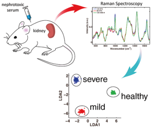 UH Engineers Develop Optical Probes for Better Diagnosis and Treatment of Kidney Disease