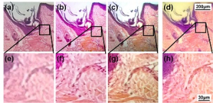 Top row shows human skin and hair follicle. a) through c) are imaged with an Olympus IX-70 microscope at a magnification of 40, 100 and 200. d) is imaged with a Nokia Lumia 520 smartphone with a PDMS lens. Bottom row shows magnified regions.