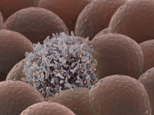 Immunotherapy works by harnessing the power of the immune system and its ability to recognize and eliminate cancer cells, like the one seen here among healthy cells. Photo courtesy: Getty Images.
