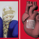 Implantable Device Can Monitor and Treat Heart Disease