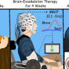 Tapping the Brain to Boost Stroke Rehabilitation