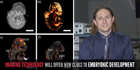 Imaging Technology Will Offer New Clues TO Embryonic Development